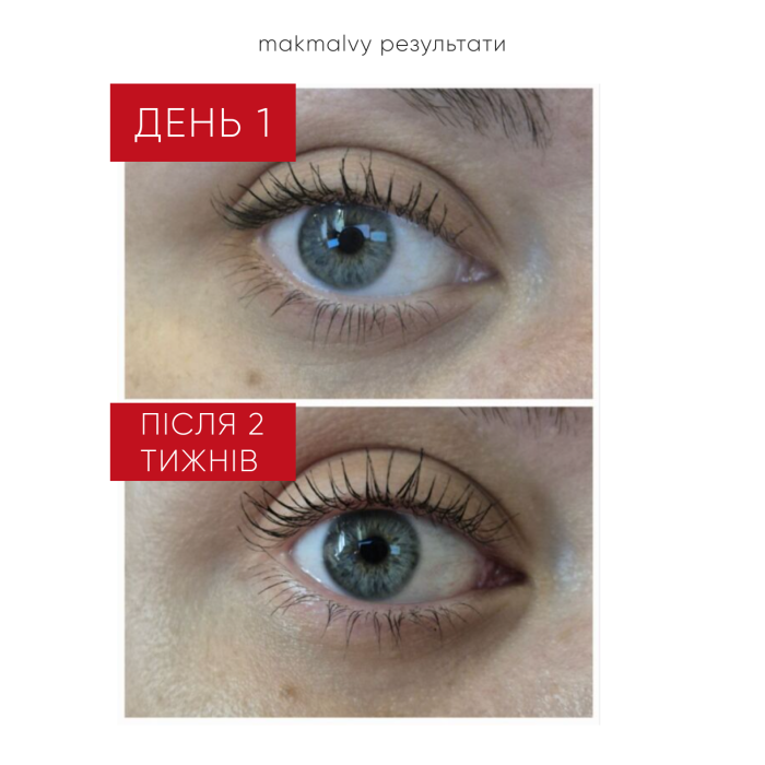 ПЕПТИДНИЙ КРЕМ ДЛЯ ШКІРИ НАВКОЛО ОЧЕЙ